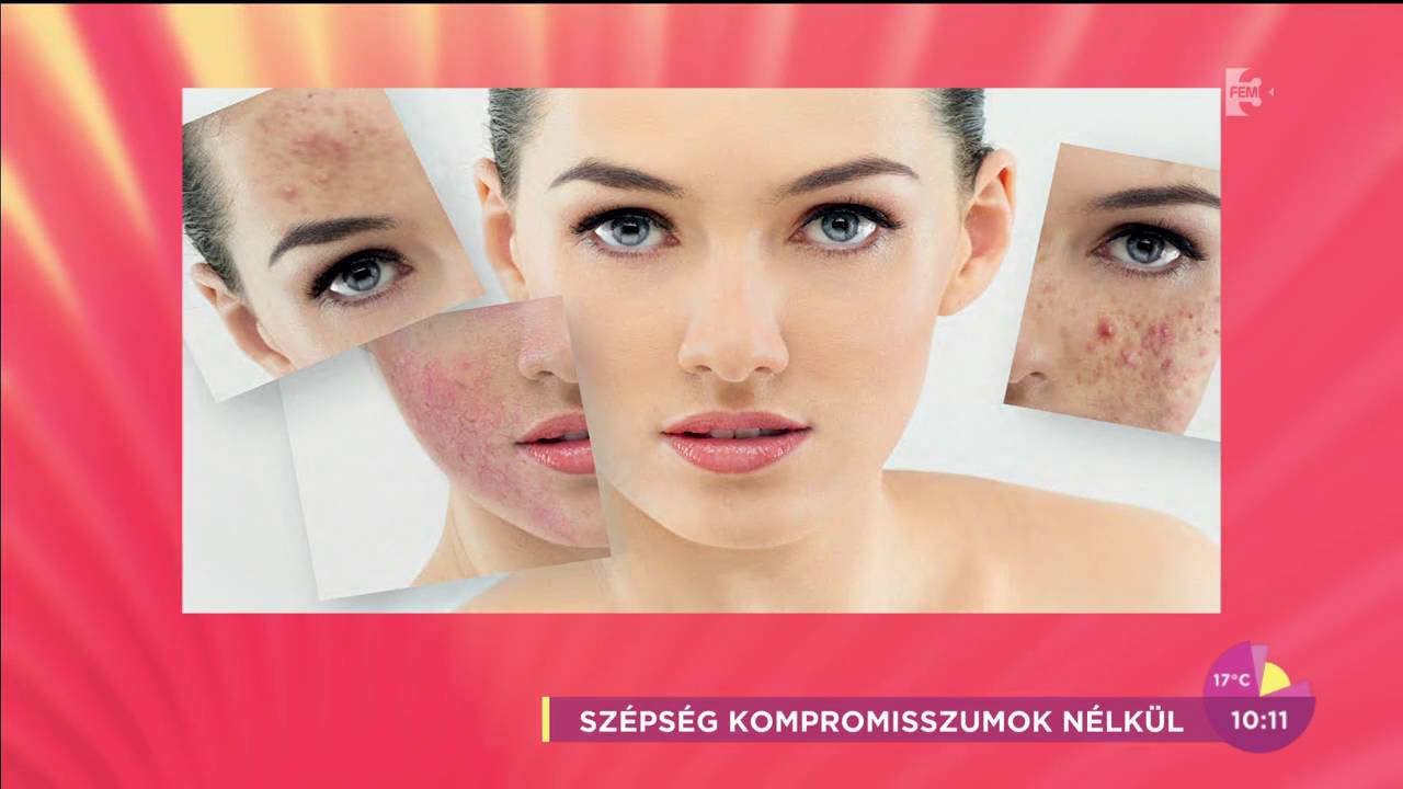 pikkelysömör az arcon hogyan kell kezelni a véleményeket