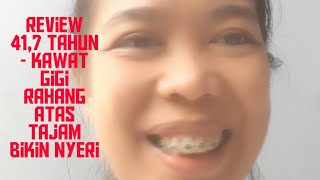 Review 41,7 Tahun berbehel-kawat gigi rahang atas tajam bikin nyeri