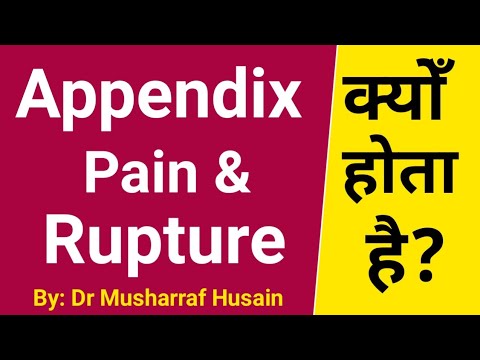 Appendicitis Causes Symptoms And Treatment