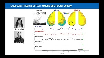 Foundation Models for Understanding Brain Dynamics | Josué Ortega Caro | NeuroFM Workshop