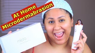 Hello queens, a company called microglo, sent me their
microdermabrasion kit to try at home and review. this is the first
time i ever o...