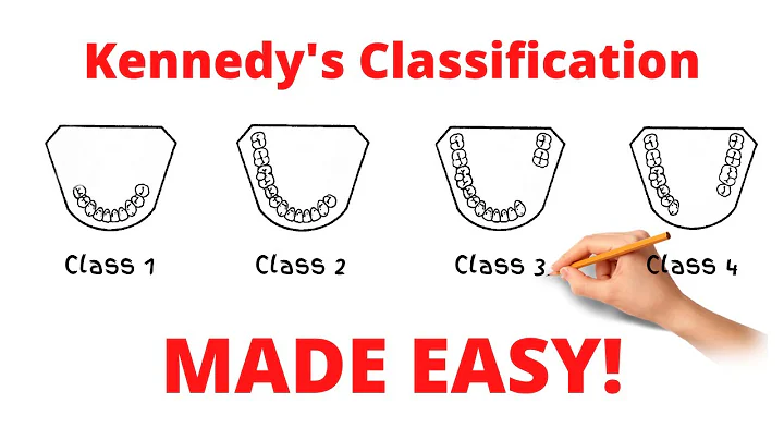 Kennedy's Classification and Applegate's rules