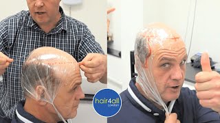 Super Easy Guide! Create Hair System 3 Minutes | Template | Non-Surgical Hair Replacement Men/Women