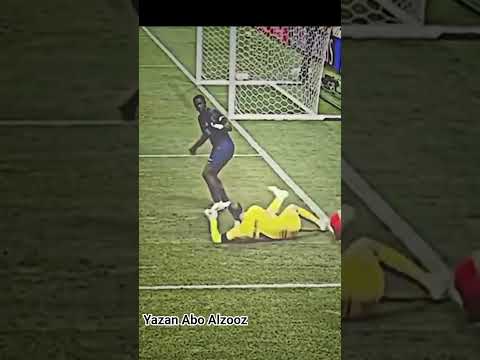 اقوى إصابة في كرة القدم إصابة لاعب نادي بايرن ميونخ جمال موسيالا و سيغيب أكثر من أربعة أشهر