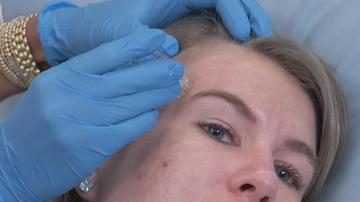 Can Botox Boost Your Facial?