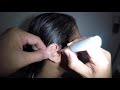 Womans earwax removal  this is huge