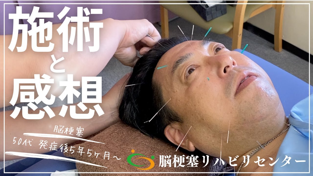 【片麻痺改善/自費リハビリ/施術内容】50代男性　発症後5年5ヶ月通所4回目　脳梗塞リハビリセンター大宮利用者様@noureha