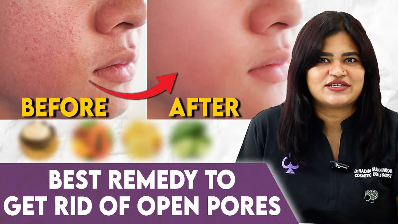 Toner Use பண்ணா Pores Tight ஆகுமா? Best Way To Minimise Open Pores - Dr Radha Subramaniyan Explains
