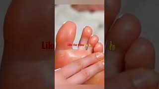 مساج يحسن السمع يخفض الضغط الدموي من القدم فقط!relaxing  foot massage