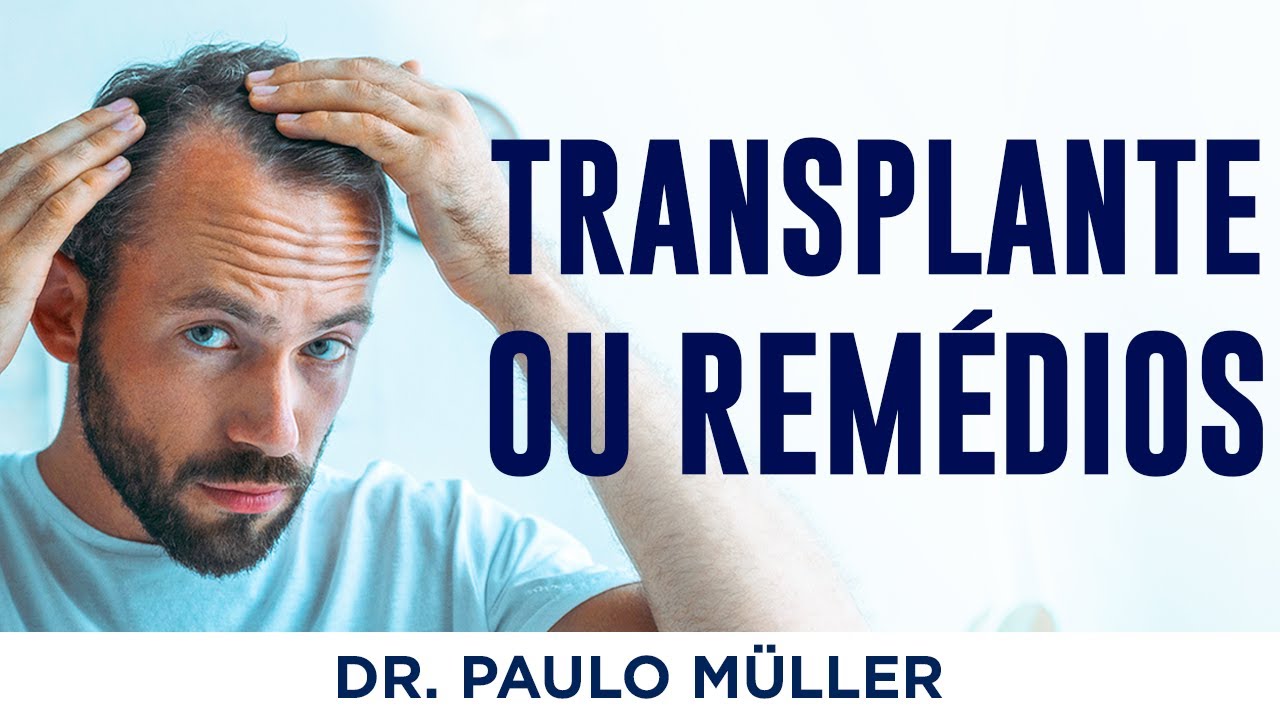 Qual melhor tratamento para Calvície, Medicamentos ou Transplante? - Dr. Paulo Müller Dermatologista