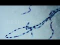 Microscope - Algae Spirogyra W m(200x Magnification)