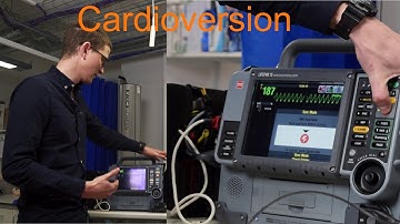 How to Perform Synchronized Cardioversion in the Field