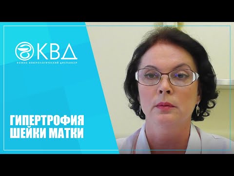 1133  Гипертрофия шейки матки