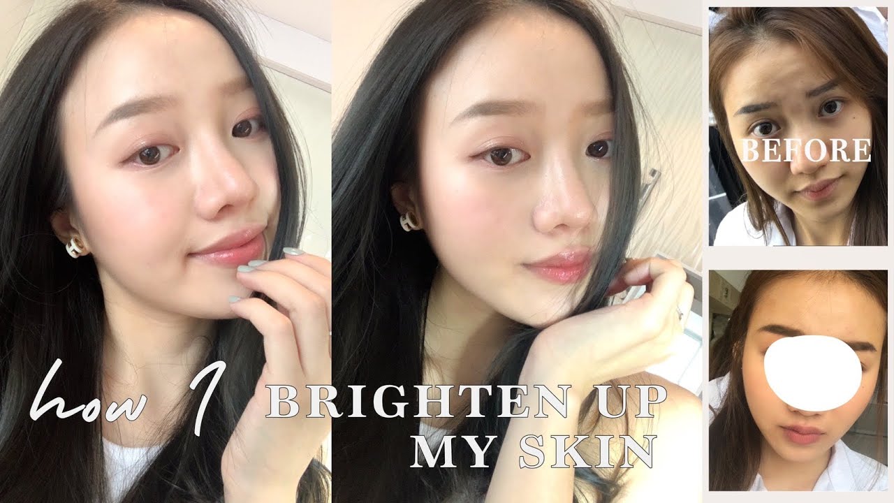 ทำยังไงให้ผิวขาวกระจ่างใส/หายเหลือง (MY SKIN JOURNEY pt.1) |wweals