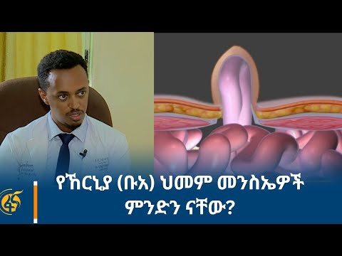 ቪዲዮ: የማስተካከል መንስኤዎች ናቸው?