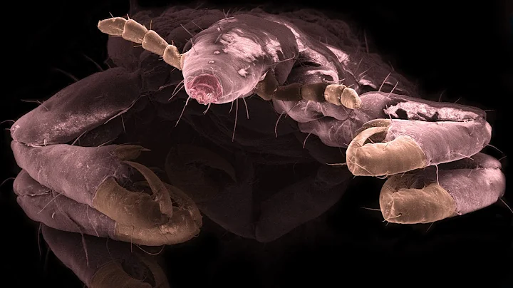 Vampire Pig Parasite | SEM | BBC Earth Explore