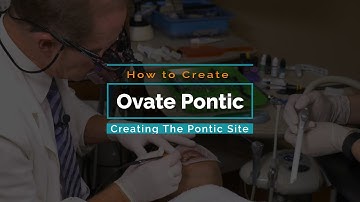 Ovate Pontic with a Diode Dental Laser Video