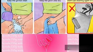 vaginal  (bikini)  qasintidan nece qurtulmaq olar? how to care of itching vaginal