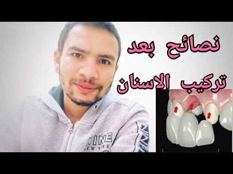 فيديو: متى يجب أن نستخدم الطرق الثابتة في C #؟