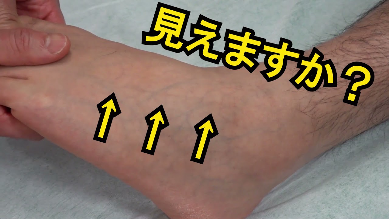 足の神経の触診（千葉大学整形外科 山口智志）