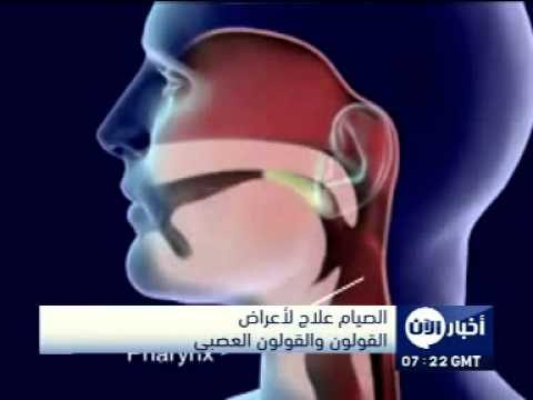 الصيام علاج لأعراض القولون والقولون العصبي