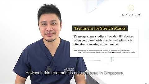 Treating Stretch Marks Effectively with Lasers and Collagen Fillers
