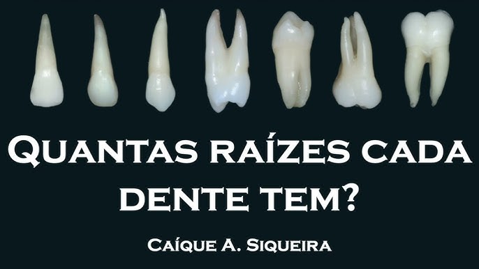 Faces dos Dentes - Quais são? Vestibular, Lingual, Palatina, Mesial,  Distal, Oclual, Incisal - YouTube