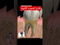 Treatment For Periodontal Pockets Teeth Teeth TikTok Explore 