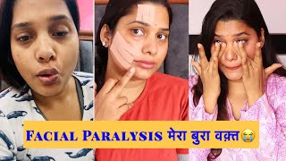 Suffering From Facial Paralysis Bells Palsy 