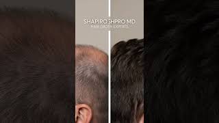 Hair Thinning? This Changed Everything!