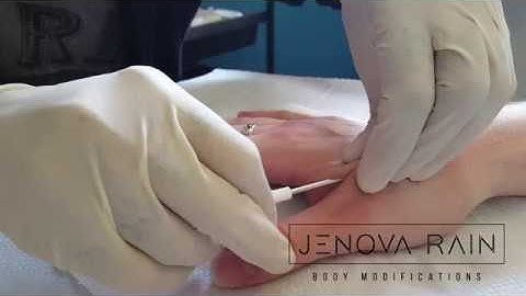 xNT NFC RFID Microchip Implant - CLOSE UP! | Jenova Rain Biohacking