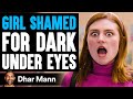 Girl shamed for dark under eyes ft christen dominique  dhar mann