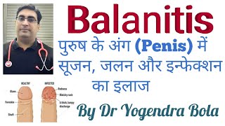 Balanitis - Infection Of Penis And Foreskin Kee Complete Information Dr Yogendra Bola In Hindi