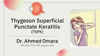 29 Wills eye manual - Thygeson Superficial Punctate Keratitis (Arabic narration)