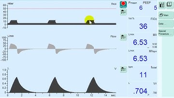Wasted Efforts due to Low Trigger Sensitivity: Ineffective Triggering