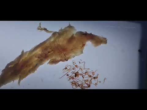 תולעי אניסקיס בדג בקלה, אניסקיס, בקלה, מרלוזה, הרב יוסף דורפמן, Rabbi Yosef Dorffman