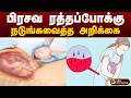பிரசவ ரத்தப்போக்கு.. நடுங்கவைத்த அறிக்கை | Postpartum hemorrhage