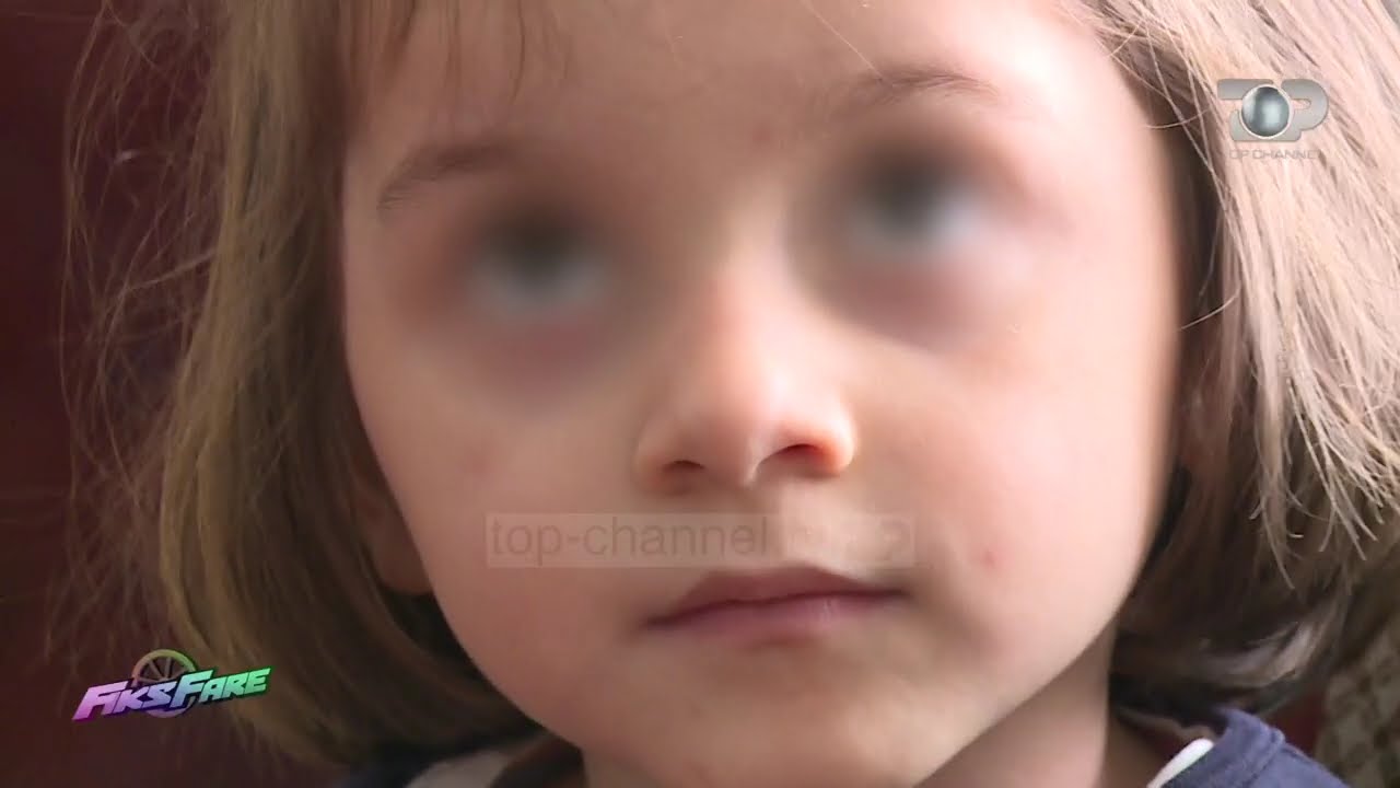 Fiks Fare/ 4 vjeçarja me vrimë në zemër ka nevojë për operacion. Nëna apel ne Fiks Fare