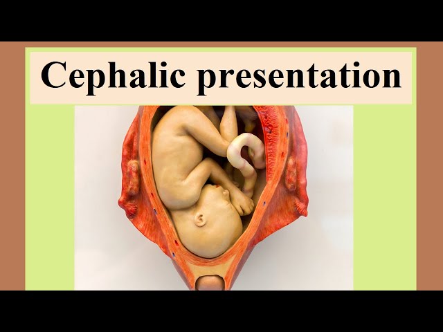 Cephalic Position: Understanding Your Baby's Presentation at Birth