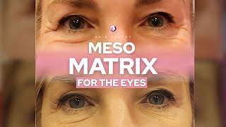 Skin Place Meso Matrix for the Eyes #MesoMatrix #Meso #ForTheEyes