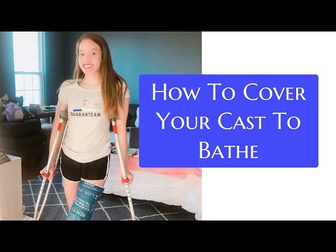 Hoe u uw Cast Om herstel Baden \ Emily's Cover