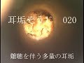 耳垢そうじ/難聴を伴う多量の耳垢/020