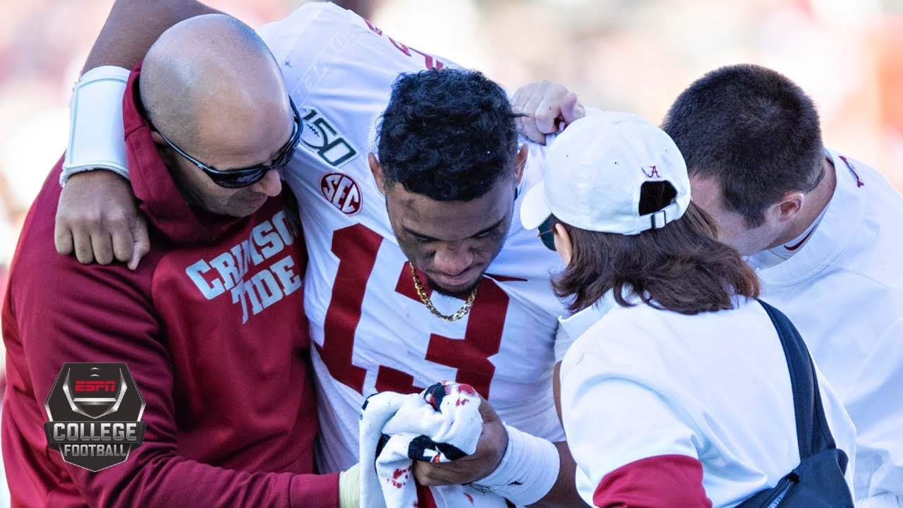 Tua Tagovailoa injury: Alabama QB out for season with dislocated ...