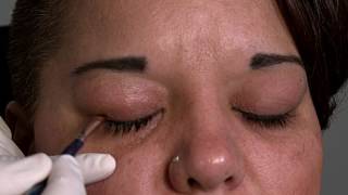 How To Use Ocusoft Oust Demodex Swabstix
