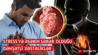 Stress-Əsəb Ürəyi̇ Bu Hala Salır - Hər Kəsi̇n İzləməsi̇ Vaci̇b Olan Vi̇deo