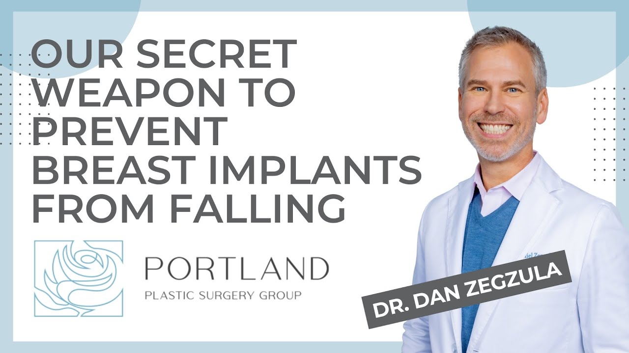 Our secret weapon to prevent breast implants from falling