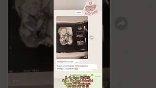 Download Lagu Kıbrısta tüp Bebek tedavisi için WhatsApp +90 533 847 40 45 MP3