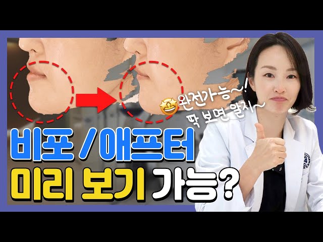 ()치아교정 후 내 얼굴을 미리 볼 수 있다면? 교정전에 꼭 확인해보세요!