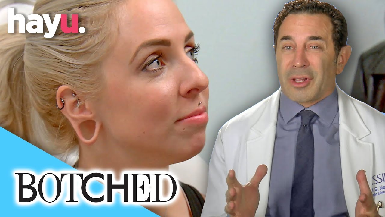 Did Woman Get Sheep's Fat Injected in Lips?! | Botched | E!