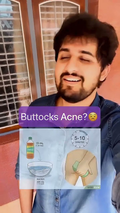 Buttocks Acne Remedies😣 #drniranjansamani #viral #youtubeindia #youtubeshorts #foryou #explore
